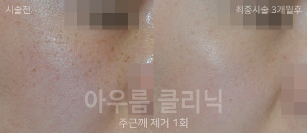 조사 범위