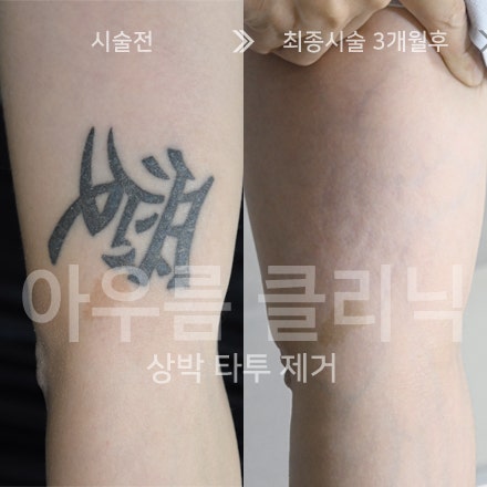 사후관리