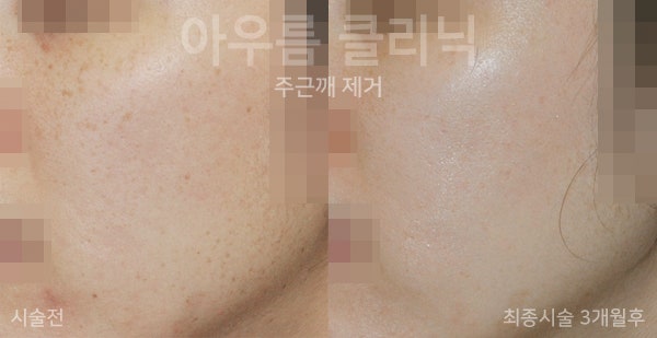 치료계획