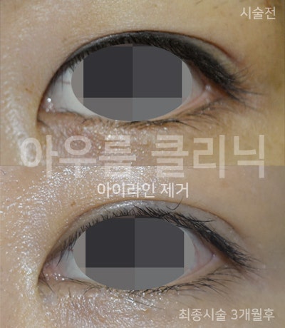 시술 장면