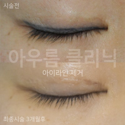 원문 이미지 16