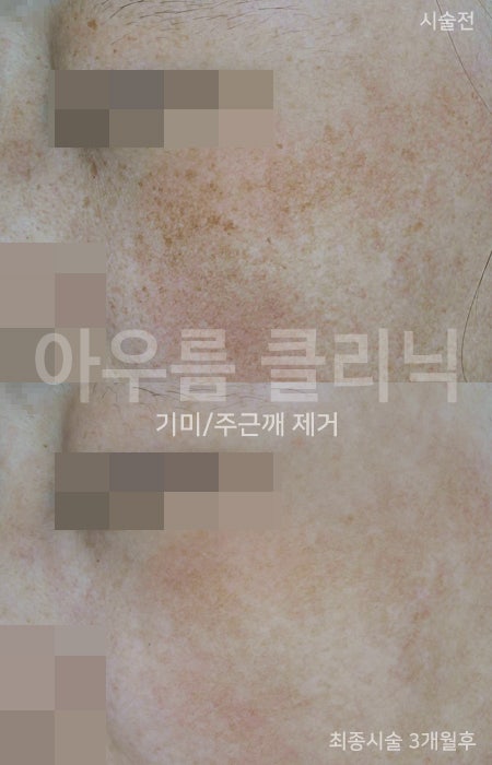 경과 확인