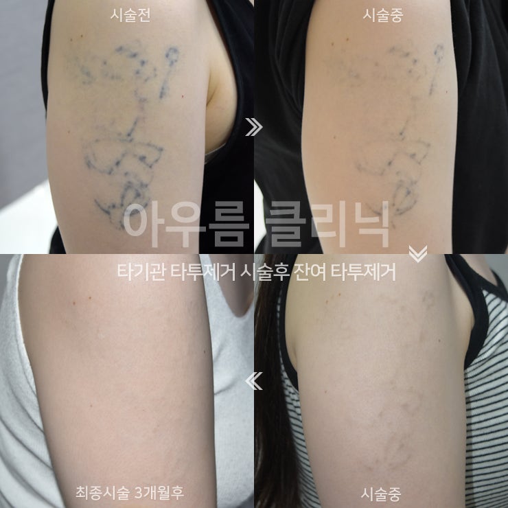 자외선차단