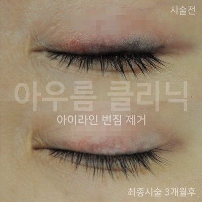 진료 상담