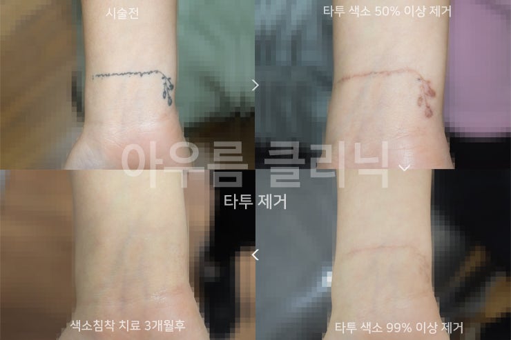 원문 이미지 2