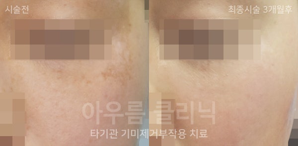 진료 상담