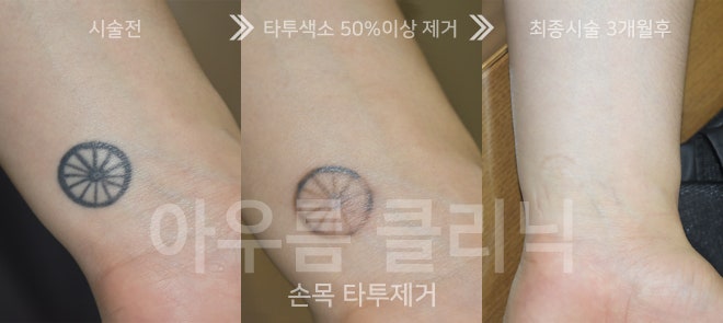 장비 구성