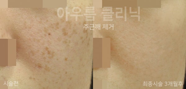 진료 상담