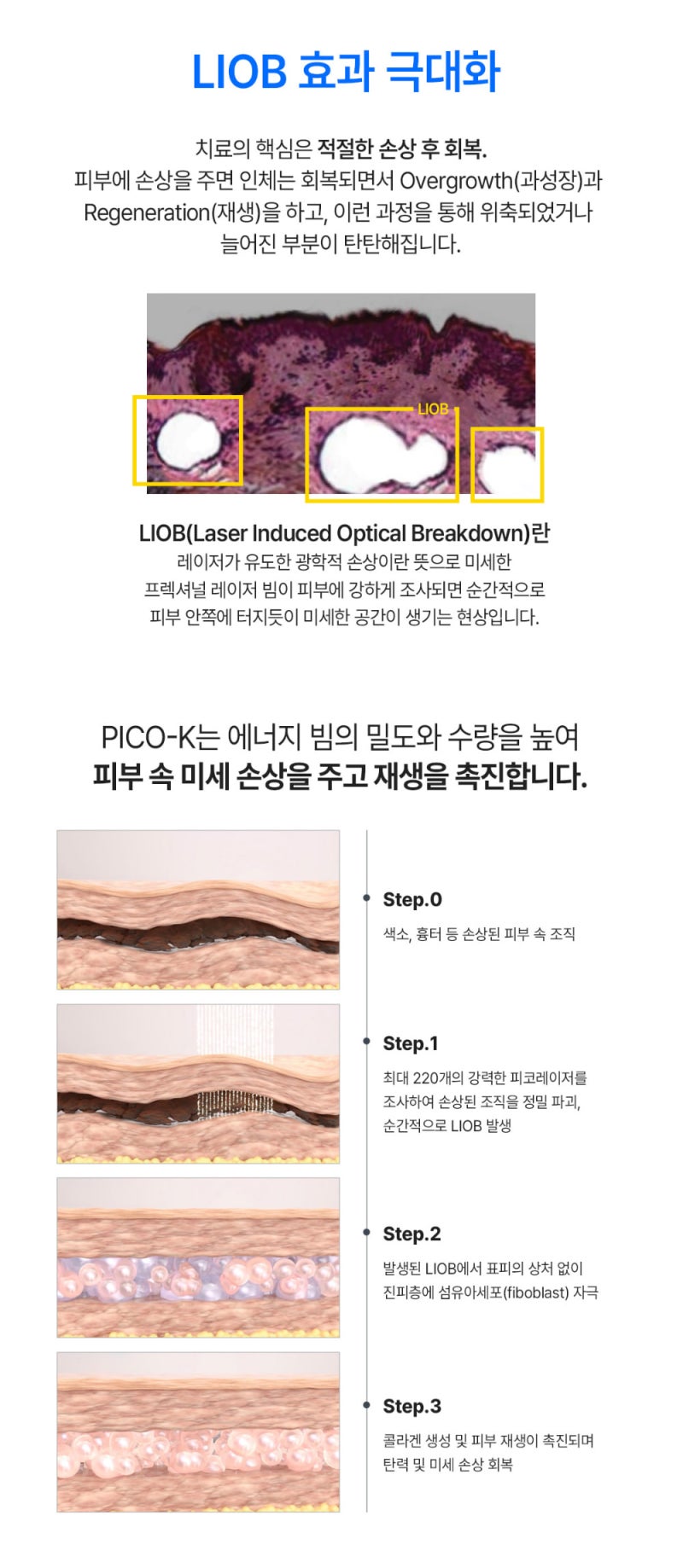 피부 관찰