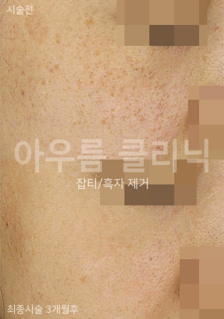아우름의원 초진에서 진행되는 색소 질환 진단과 상담 절차 — 아우름의원