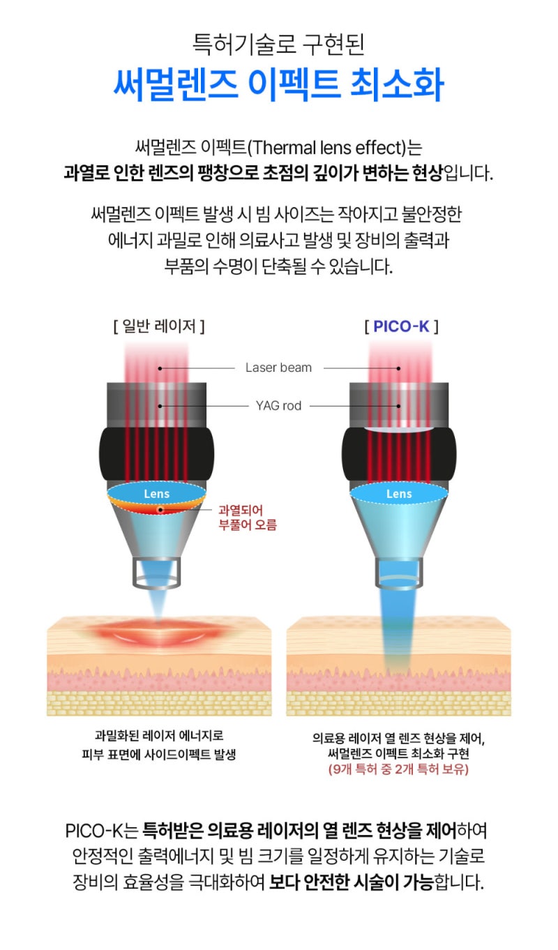 조사 범위