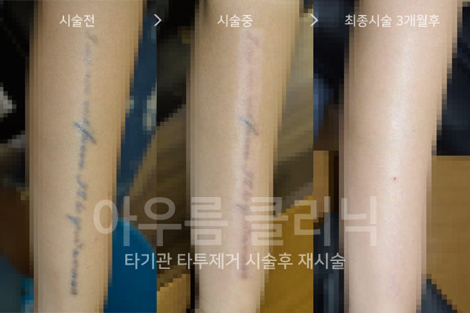 장비 구성
