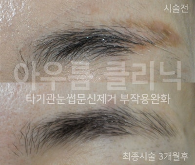 장비 화면