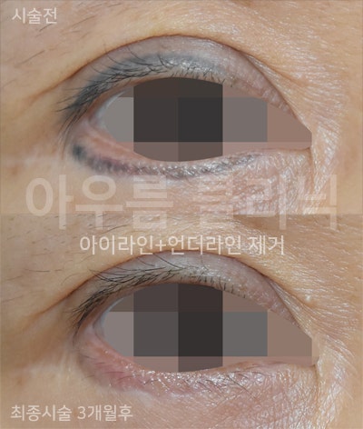 부위 확인