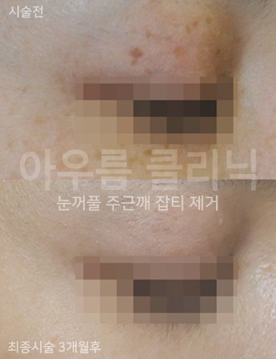부위 확인