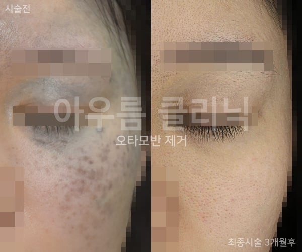 치료계획