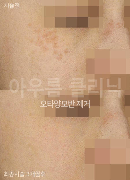 관찰포인트