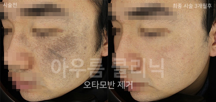관찰기록