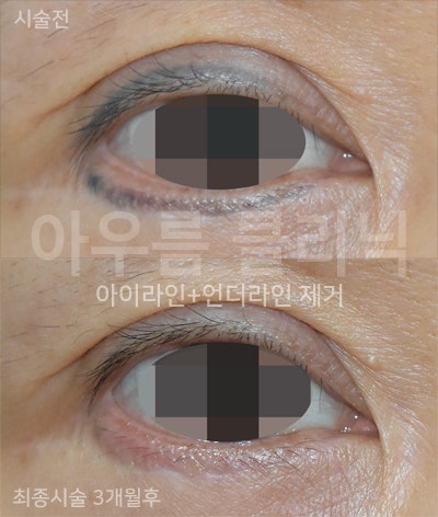 원문 이미지 11