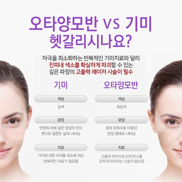 관리방법
