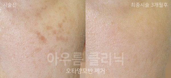 경과확인