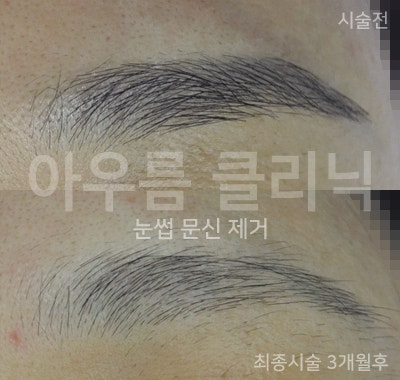 상담메모