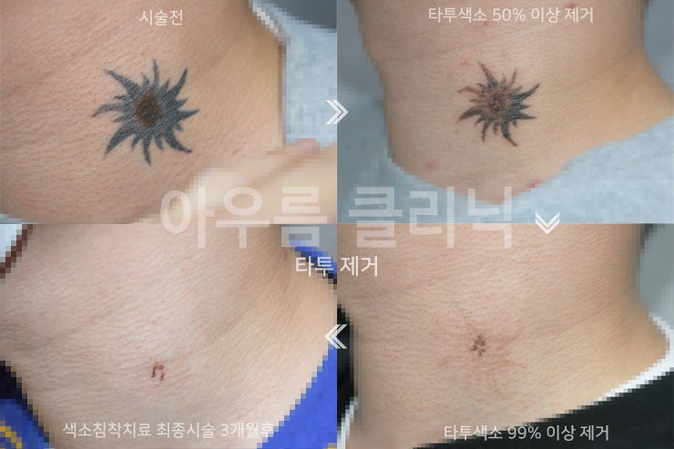 원문 이미지 7