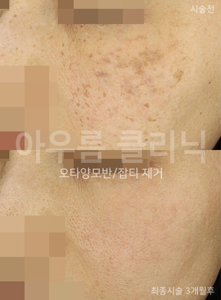 비교사진