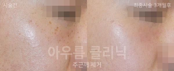 관찰기록