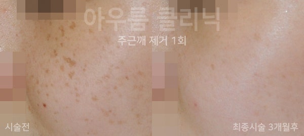 관찰포인트