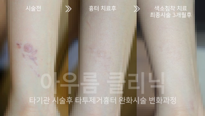 원문 이미지 2