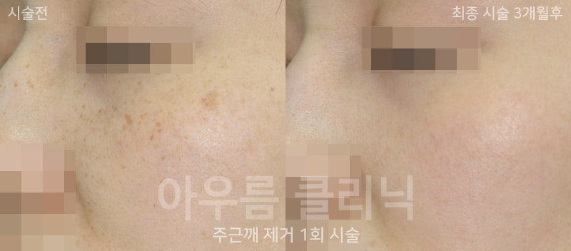 비교사진