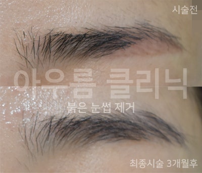 보호막형성