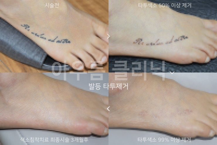 원문 이미지 11
