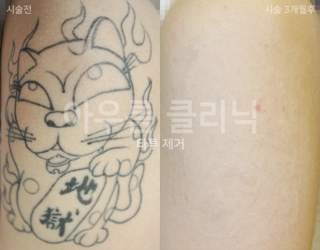 진행경과