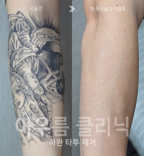 상담메모