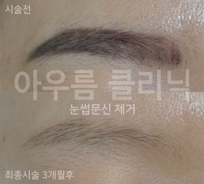 원문 이미지 2