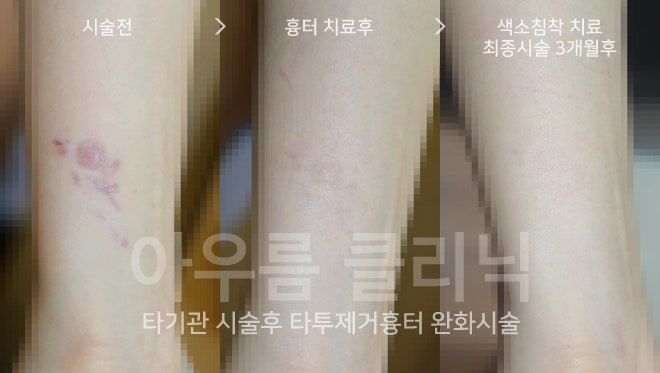 자외선차단