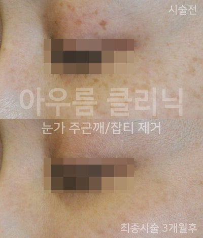 장비 화면