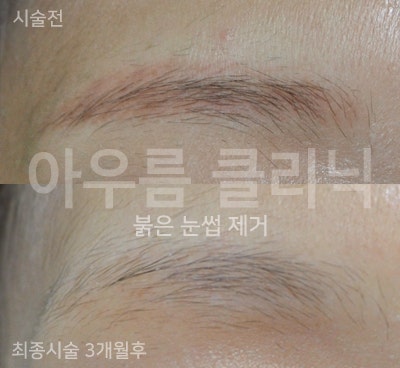 관리안내