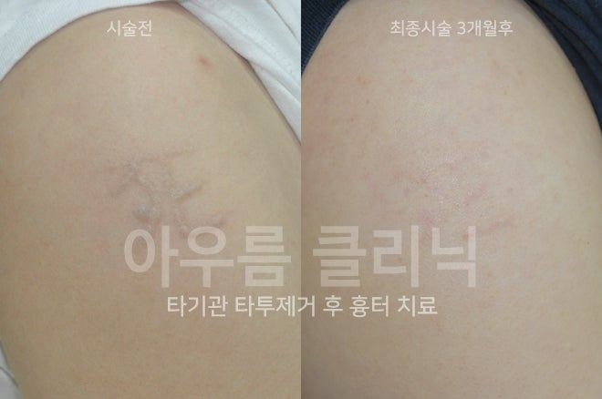 부위비교