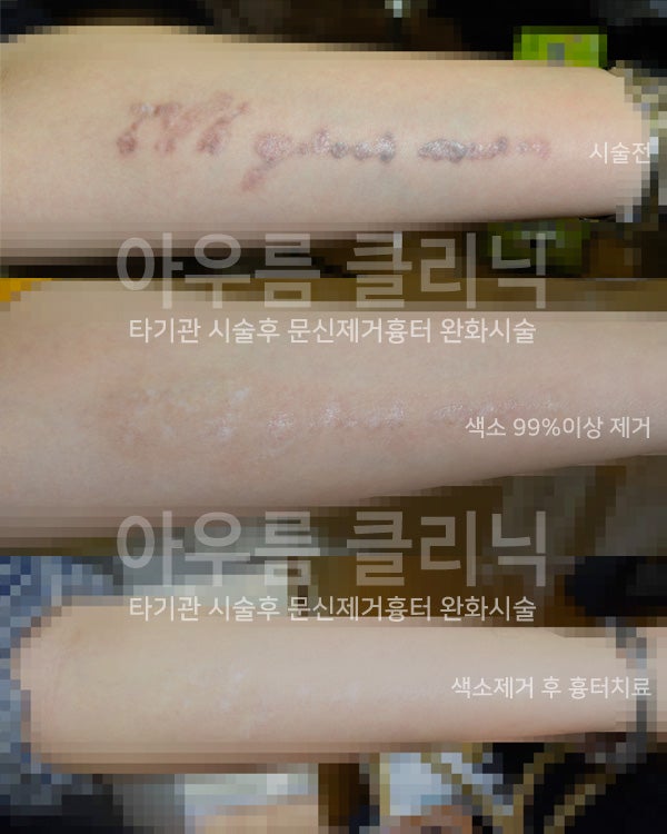 피부 상태