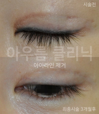 경과 확인
