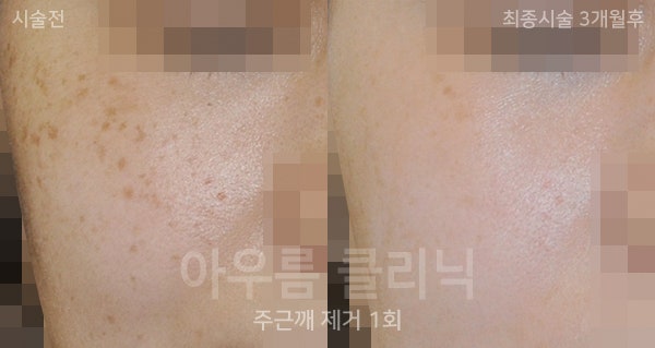 색상차이