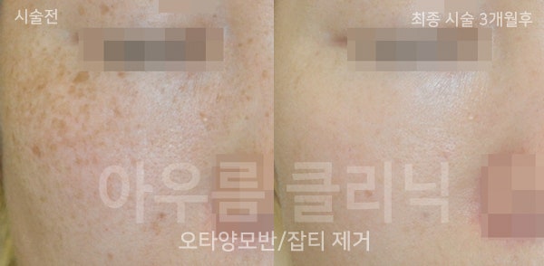 진료상담