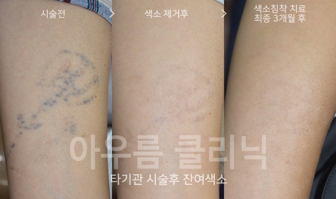 관리 안내